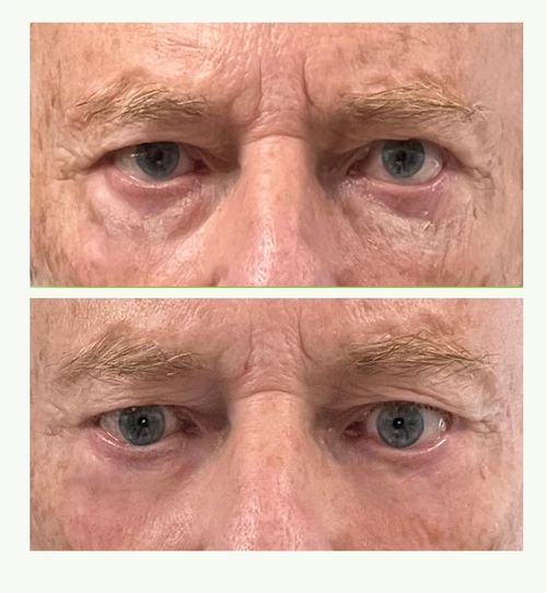 InstantSmooth - Reafirmante para ojos